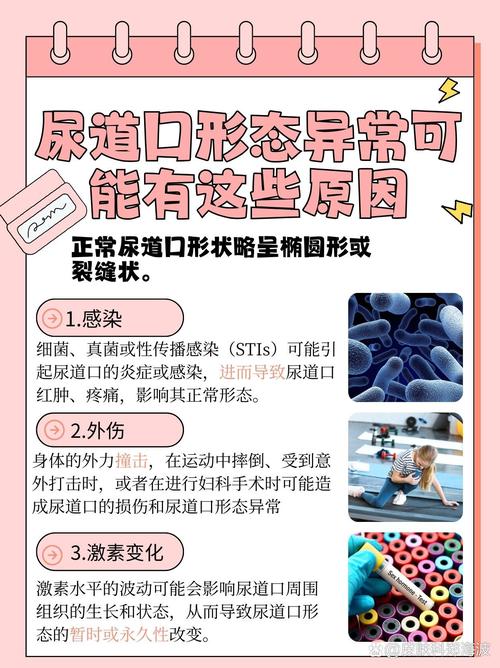 我操老师的逼的相关介绍